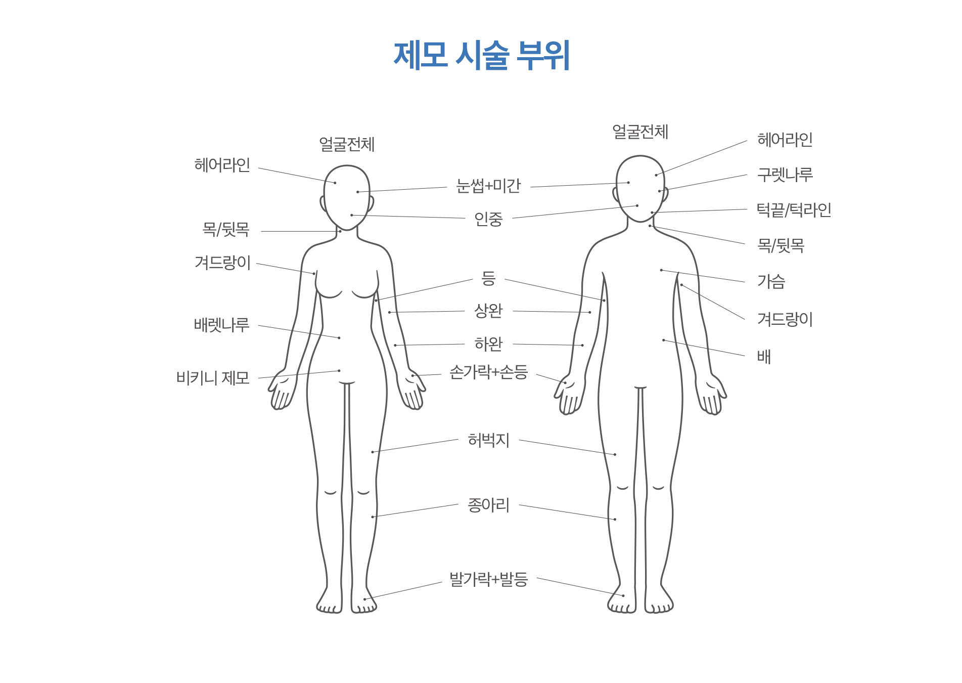 제모 시술 부위