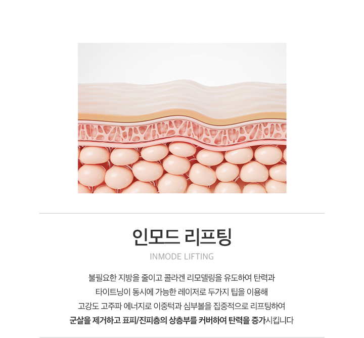 인모드 리프팅