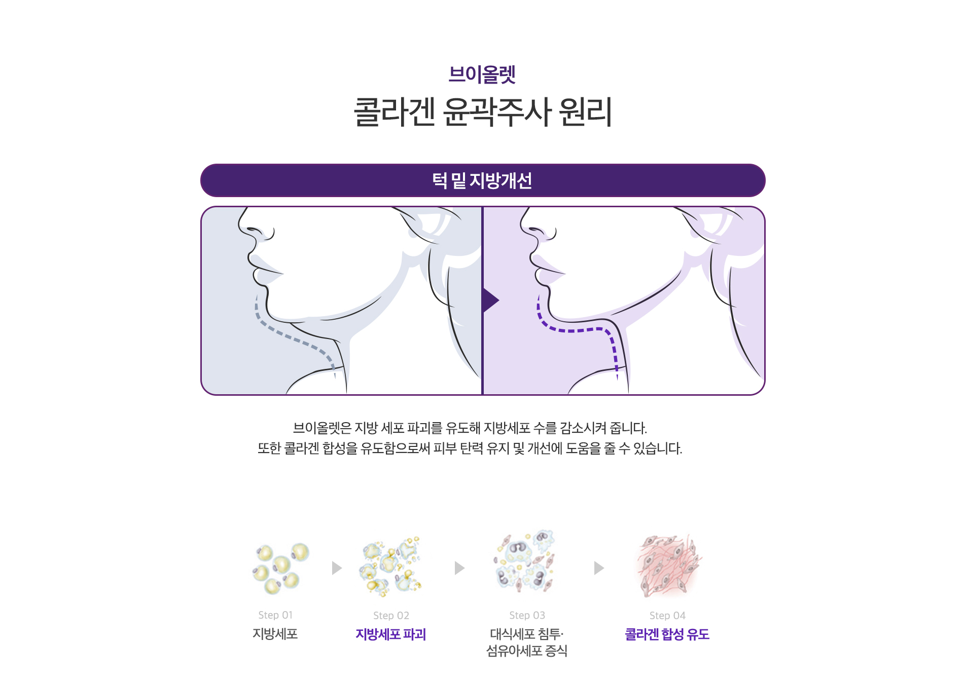 콜라겐 윤곽주사 원리