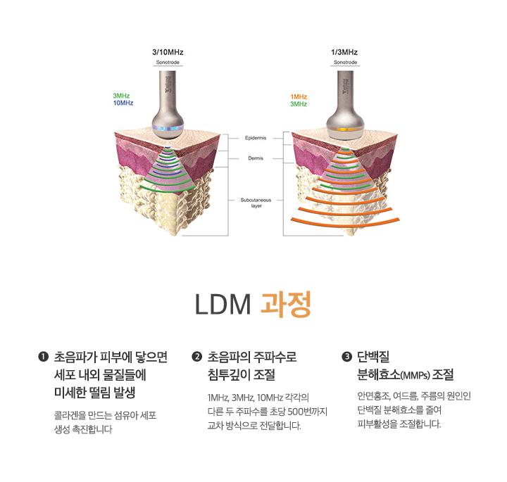 LDM 과정