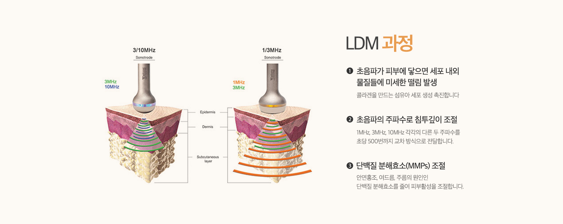 LDM 과정