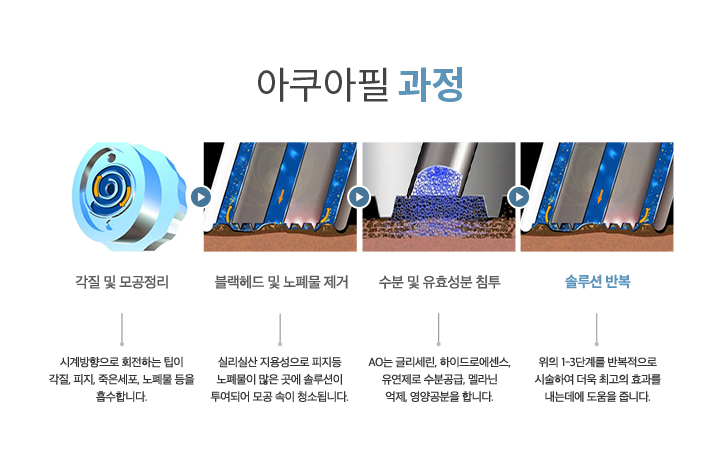 아쿠아필 과정